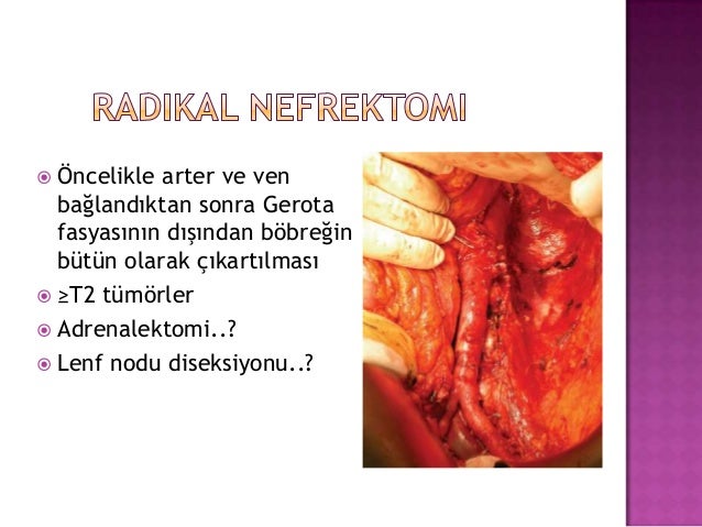İğne Oyası İkiz Çiçekler Modeli Yapımı Türkçe Anlatımlı Videolu İğne Oyası İkiz Çiçekler Modeli Yapımı Türkçe Anlatımlı Videolu